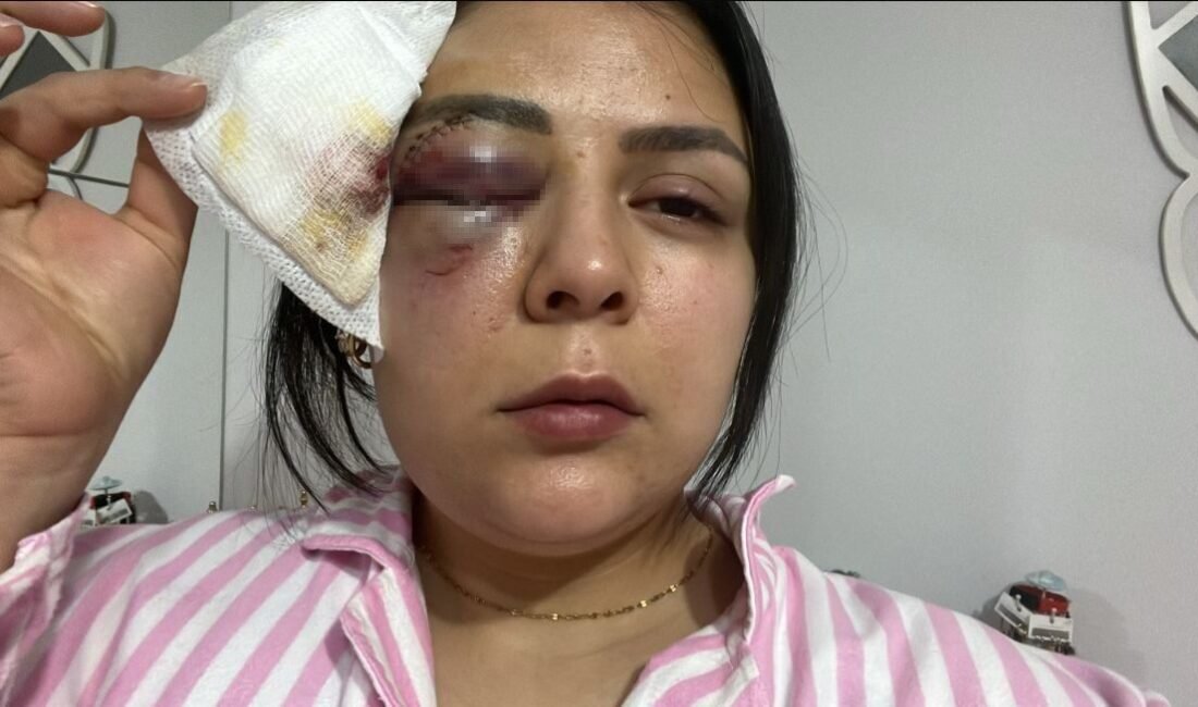 Kahramanmaraş’ın Pazarcık ilçesinde yolda yürürken tanımadığı bir kişinin yumruklu saldırısına