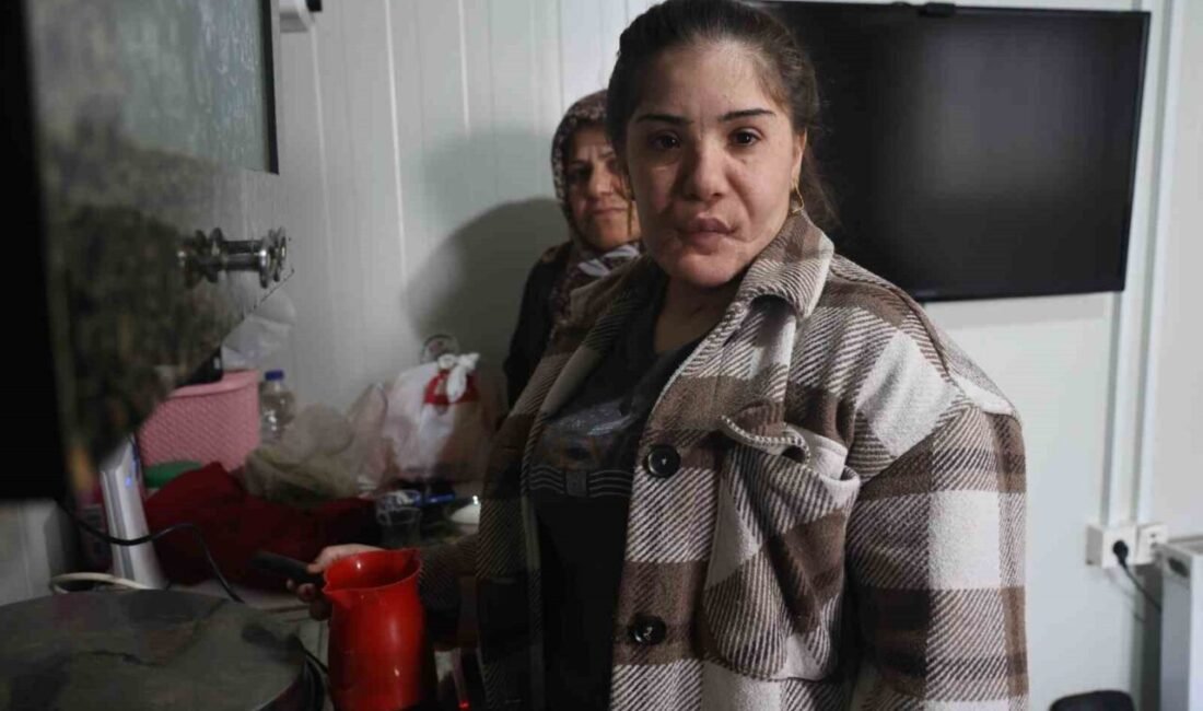 Hatay’da 6 Şubat depremlerinde enkaz altından yaralı kurtarılan ve aldığı