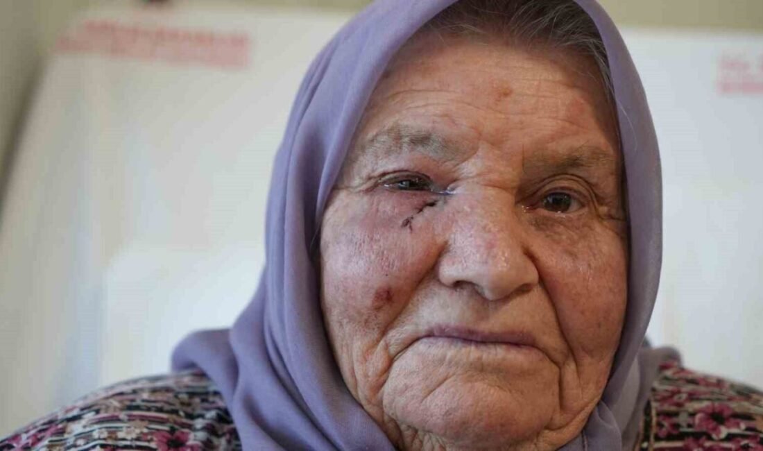 Burdur’da 4-5 yıldır gözyaşı kanalı tıkanıklığı ve tekrarlayan enfeksiyonlarla mücadele