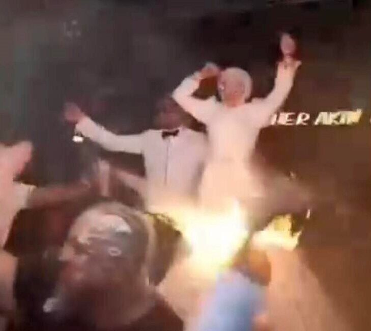 Mersin’de bir düğünde yapılan meşale şovu sırasında saçı alev alan