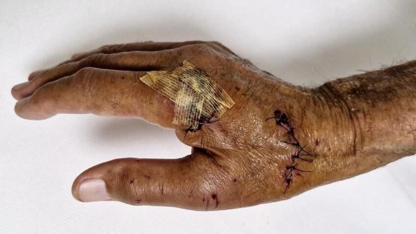 Antalya’da yaşayan Akdeniz Üniversitesi’nden emekli öğretim görevlisi Kemal Koçak (80),