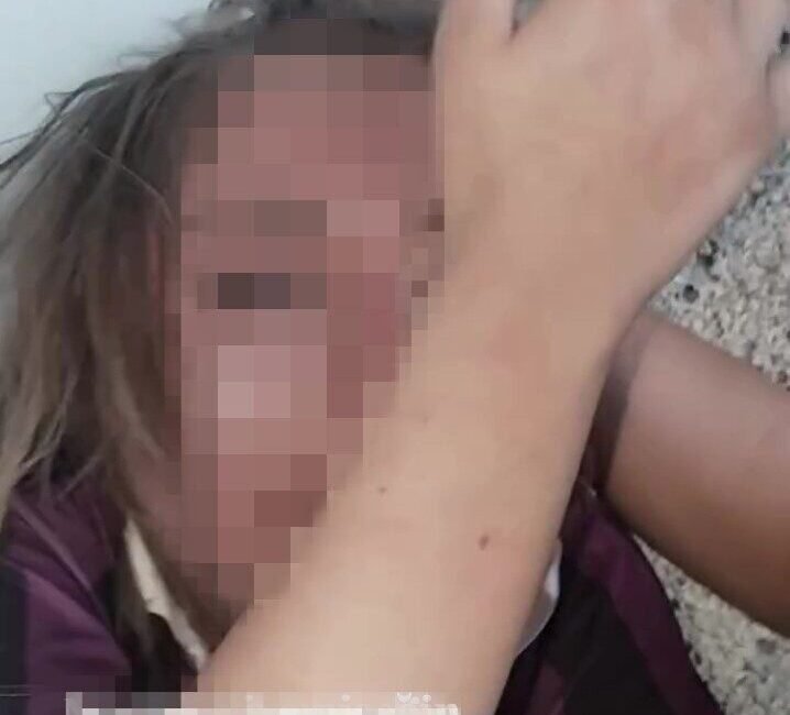 Antalya’da bir genç kız, erkek arkadaşları ile görüştüğü iddia edilen