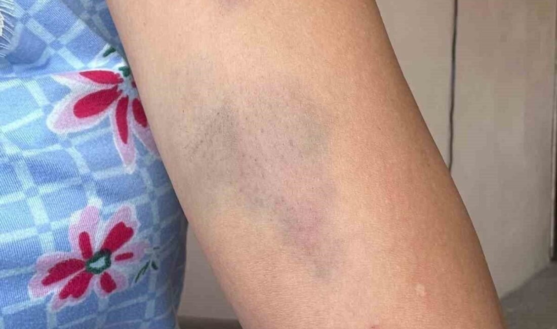 Adana’nın Pozantı ilçesinde yayla evinin önünde sokak köpeklerini besleyen veteriner,