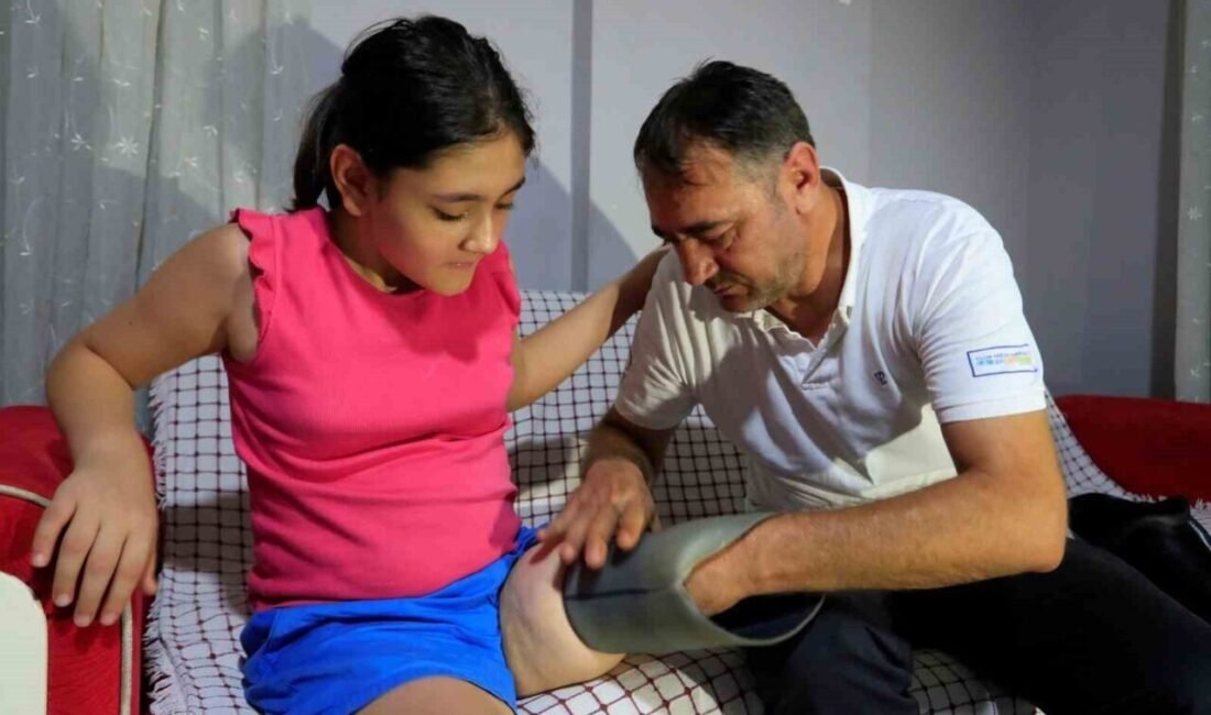 Küçük yaşta sol bacağı kesilen ve babasının evin tavanına kurduğu
