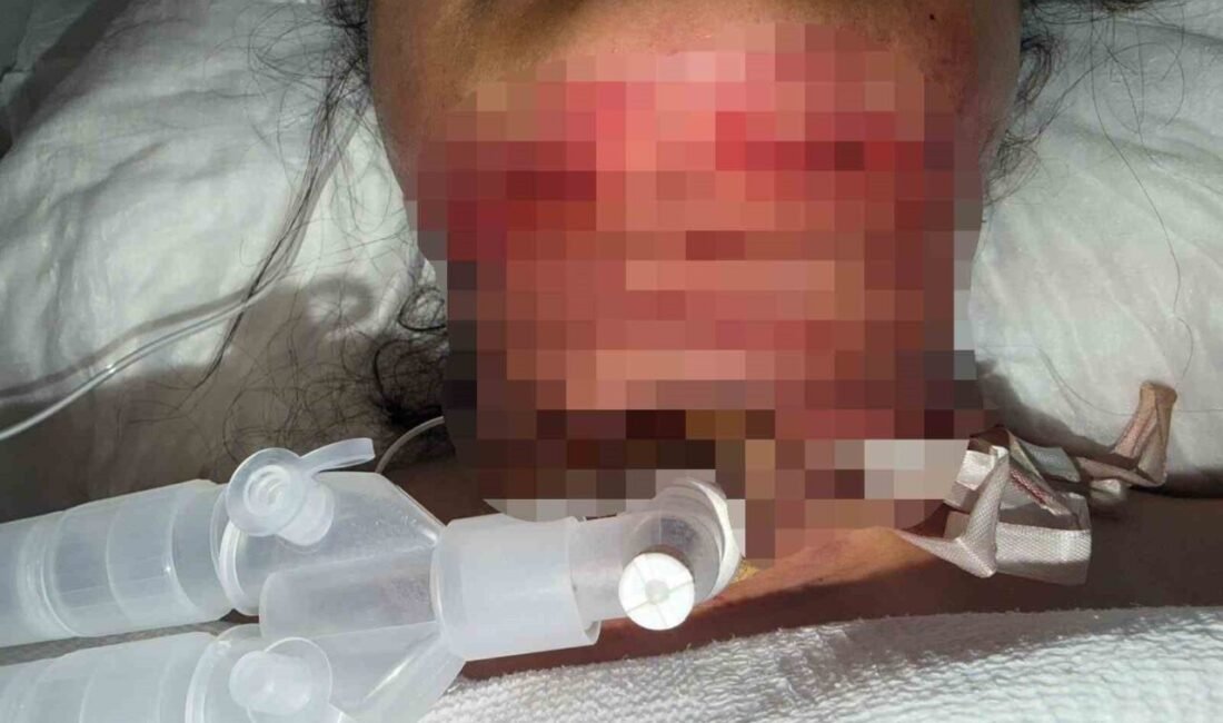 Antalya’da gıdı yağlarını aldırmak ve cildini sıkılaştırmak için özel bir